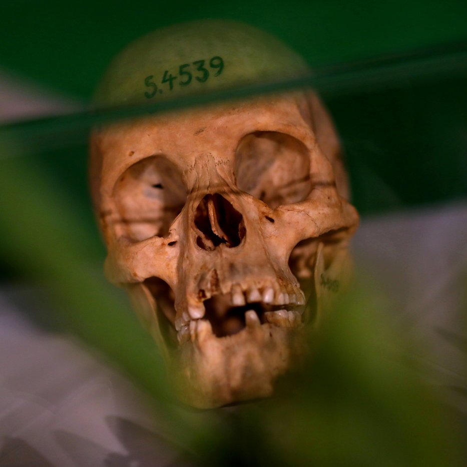 L'image montre un crâne humain placé sous une vitrine. Le crâne est beige, avec des détails visibles des dents et des cavités. Un numéro, "S.4539", est inscrit sur le sommet du crâne. En arrière-plan, on aperçoit des formes floues qui semblent être de la végétation, ajoutant une touche de verdure à la scène. La lumière se reflète légèrement sur le verre de la vitrine, créant un effet de transparence. L'ensemble dégage une ambiance à la fois scientifique et légèrement mystérieuse.