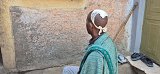 Alemu Haile, 37 ans, a été blessé par balles lors de la manifestation à Adi Gudum, le 11 mars.